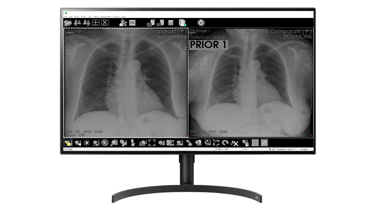 8MP Diagnostic Monitors for radiology