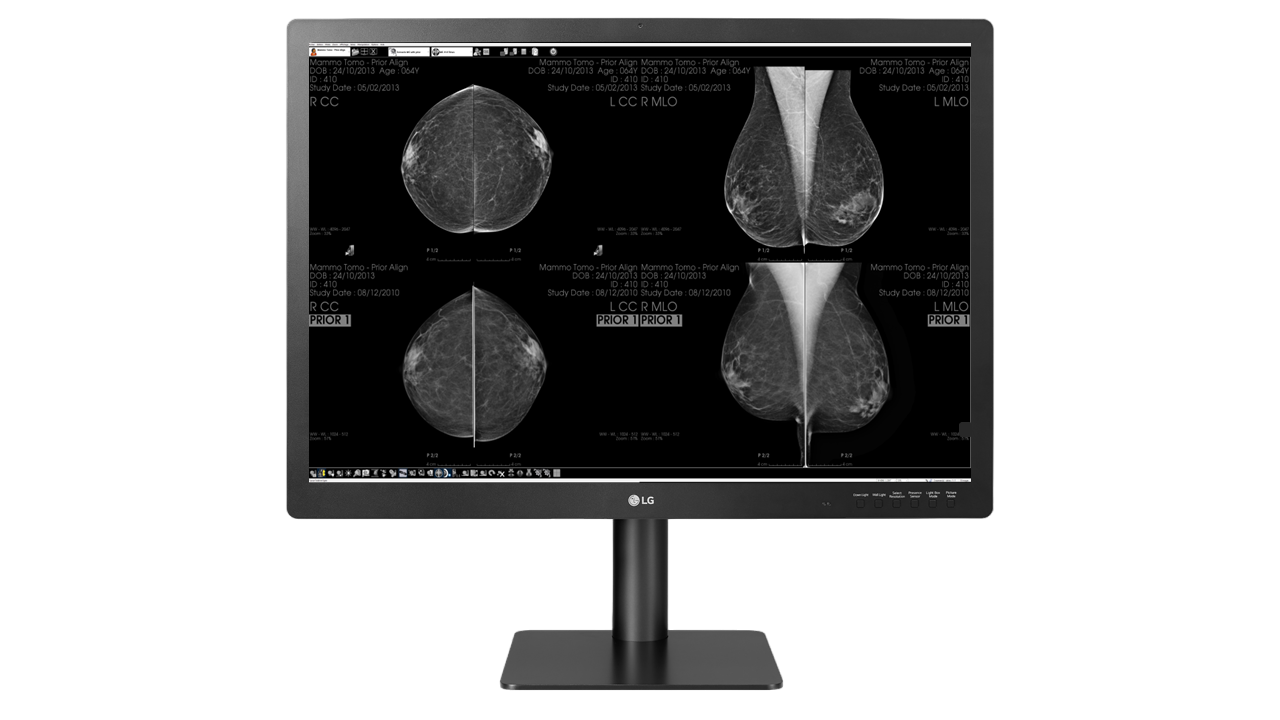 12 MP Ecran de diagnostic pour la mammographie