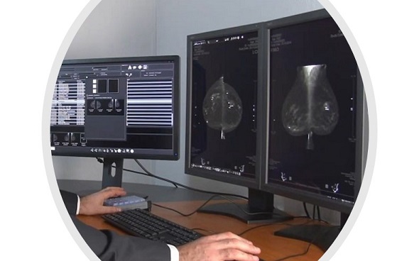 Soluzione de diagnostico per mammografia e tomosintesi
